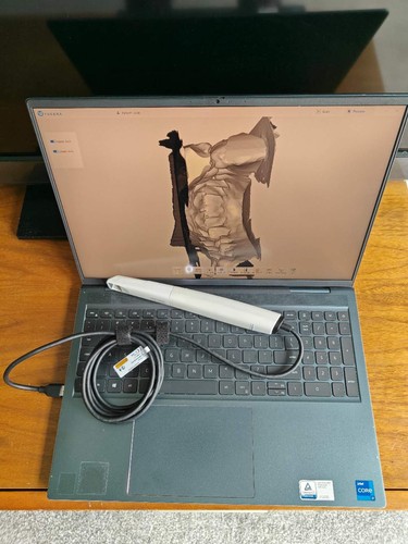Ultraslim intraoraler dental - intraoraler,