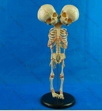 Baby Skelett mit Doppelkopf