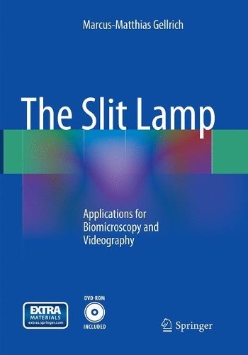 The slit lamp - the,
