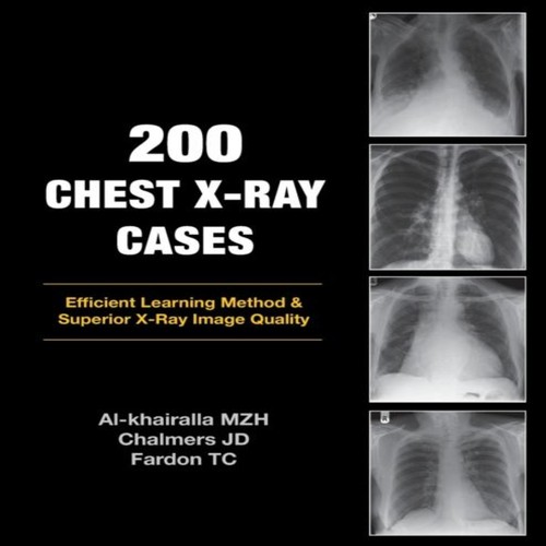 200 chest ray - 200, x-ray