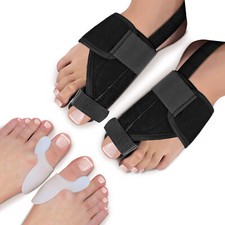 Hallux Valgus Korrektur