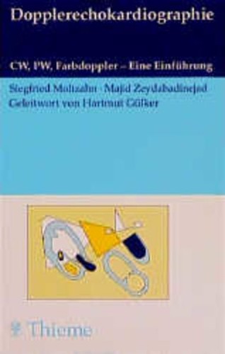 Dopplerechokardiographie cw - dopplerechokardiographie.,