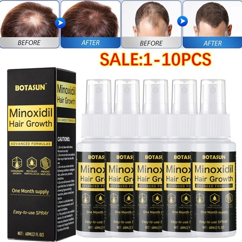 Stück minoxidil spray - 8,