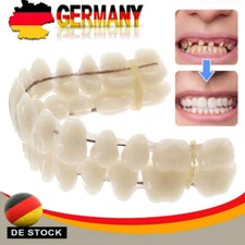 Snap On Veneers Kosmetische