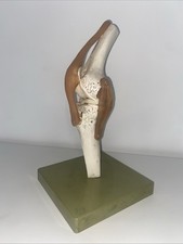 Br) SOMSO Modell Kniegelenk Funktionsmodell Schulmodell