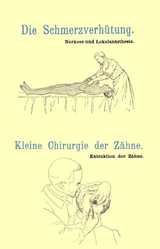 Schmerzverhütung narkose - schmerzverhütung,