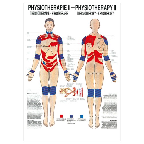 Thermotherapie mini poster - thermotherapie, mini-poster