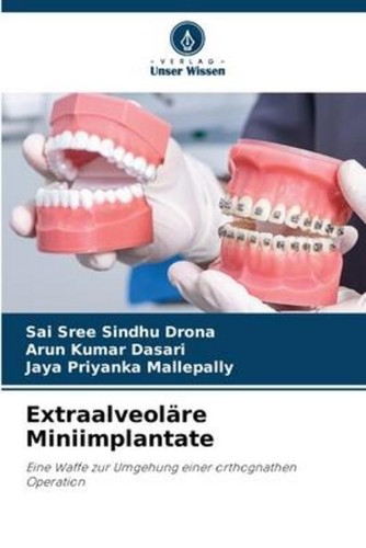 Extraalveoläre miniimplantate - extraalveoläre,