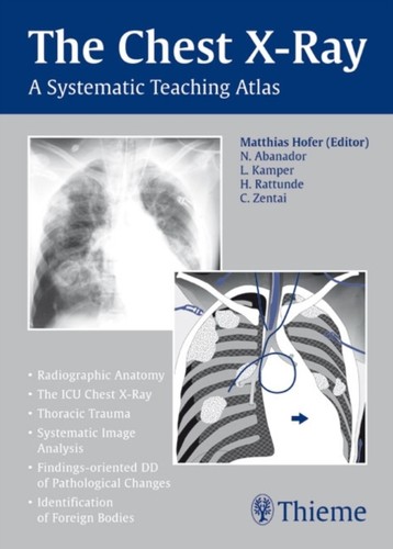 The chest ray - a, systematic
