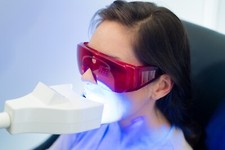 Kosmetische Zahnaufhellung