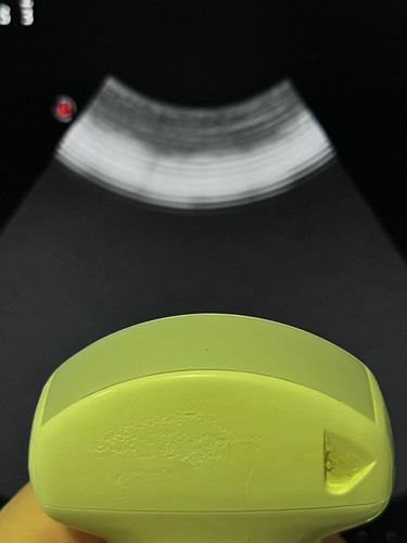 Esaote probe ca431 ultrasound - ca431,