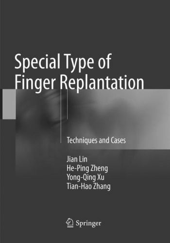 Special type finger - special,