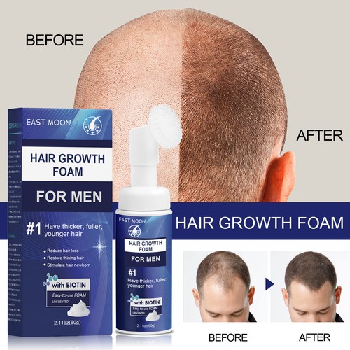 Männer haarverdichtung schaum - haarverdichtung,
