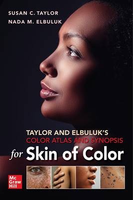 Taylor and elbuluk - taylor, elbuluk's