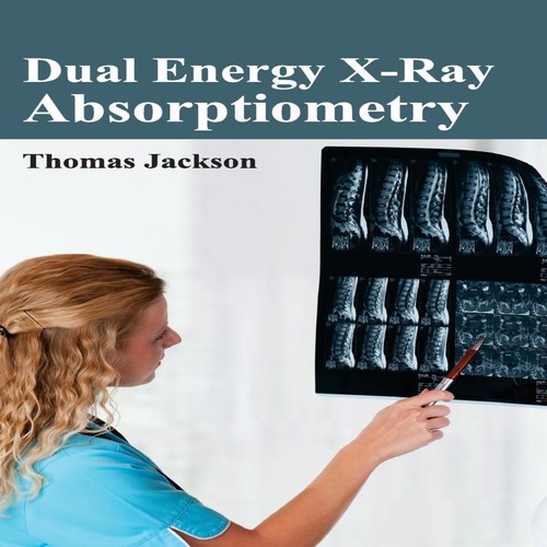 Dual energy ray - energy, x-ray