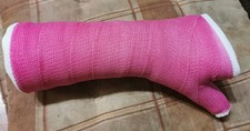 Gipsarm Unterarm/Daumen Pink