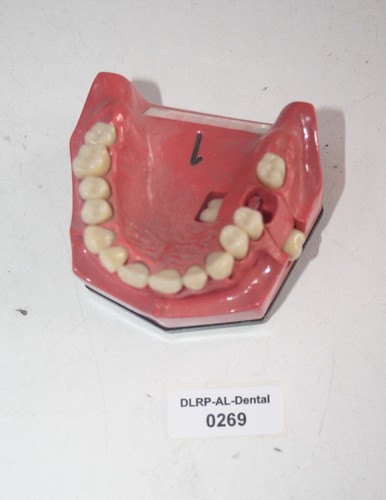 Dent schaumodell 1 - go,