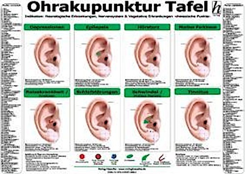 Ohrakupunktur tafel - ohrakupunktur,