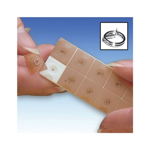 100 ratiomed akupunkturnadeln - 100,