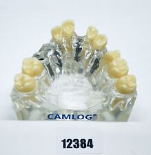 CAMLOG Demomodell Schaumodell Implantat Oberkiefer Acrylglas   OVP