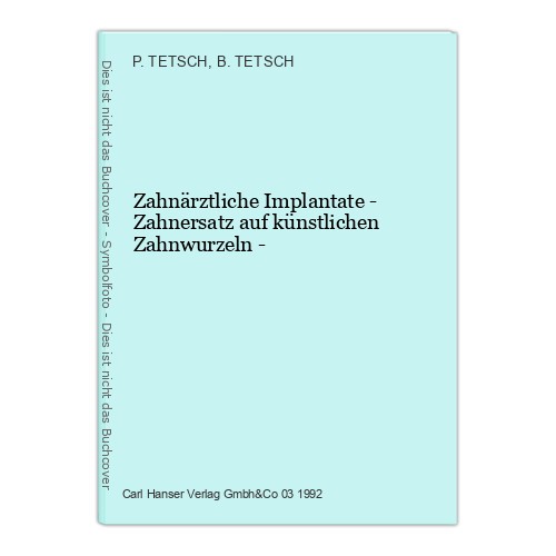 Zahnärztliche implantate - zahnärztliche,