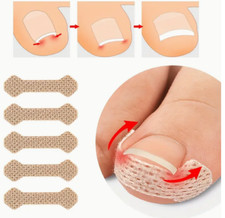 Eingewachsener Zehennagel Korrektur Pflaster Fußnagel Nagel Klammer Pediküre DE