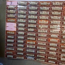 Zahngarnituren , Bioplus ,Vita , Diverse  Herstell. Verschiedene Farben  Größen