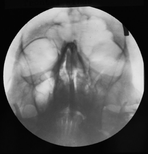 Magic lantern slide xray - magic,