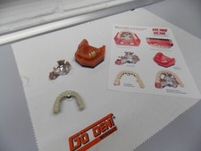 Go Dent "Spezialmodell", 14-gliedrige Keramikbrücke auf TK's u. Impl, neu!!!