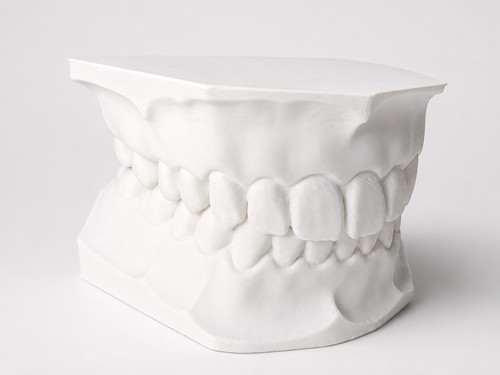 Zahnmodell druck dental - zahnmodell, 3d-druck