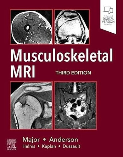Musculoskeletal mri third - musculoskeletal, mri,
