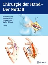 Chirurgie der hand - chirurgie,