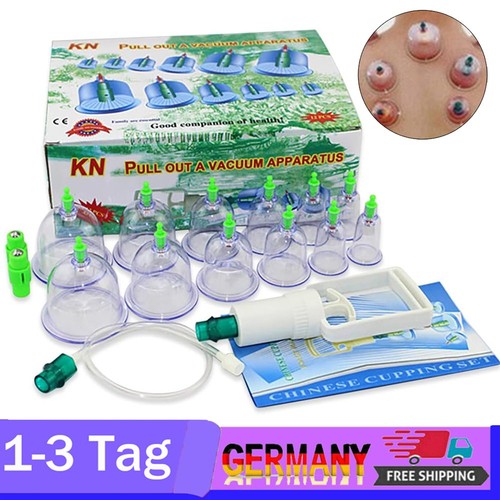 Schröpfen set für - set,