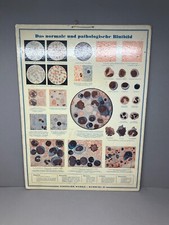 Alte lehrtafel pathologisches - alte,