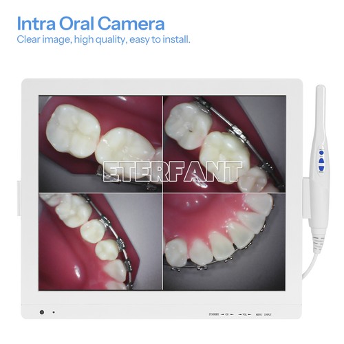 Dental zahn intraoral - dental, zahn-intraoral-kamera