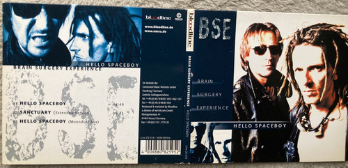 Brain surgery experience - experience,