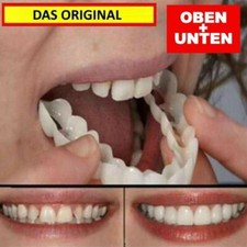 Snap On Veneers Kosmetische Zahnblende Comfort Prothese Falsche Zähne Flex Fit