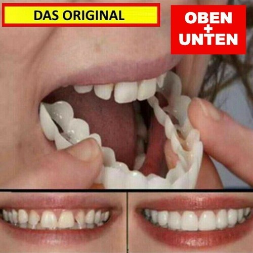Snap veneers kosmetische - on,