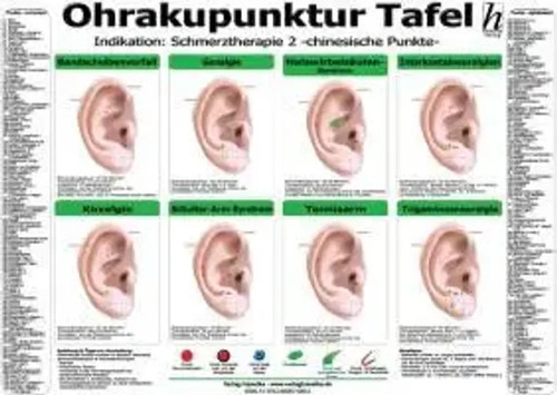 Ohrakupunktur tafel - ohrakupunktur,