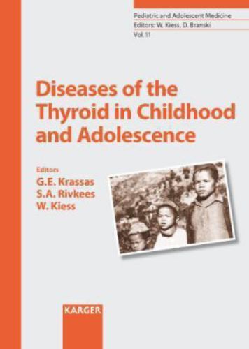 Diseases the thyroid - diseases, of