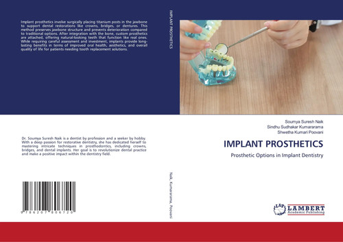 Implant prosthetics prosthetic - implant,