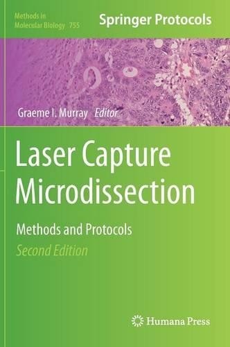 Laser capture microdissection - capture,