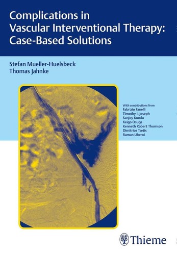 Complications vascular - complications,