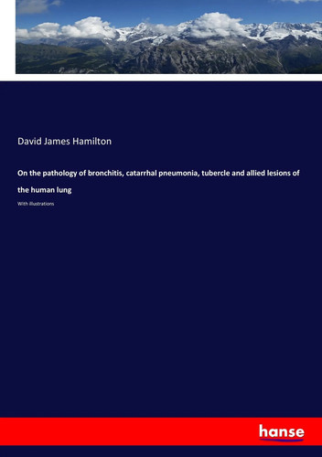 David james hamilton on - david, the