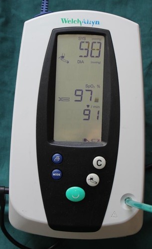 Welch allyn vital signs - allyn,