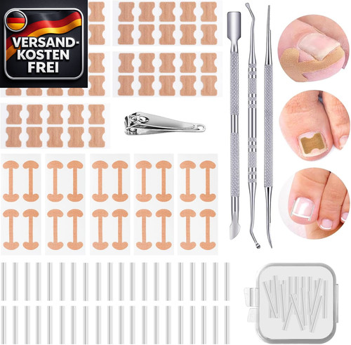 Eingewachsene zehennagel set - zehennagel,
