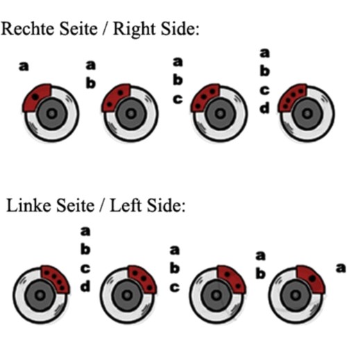 Bremssattelkolben