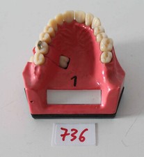 Dent schaumodell 1 - ,