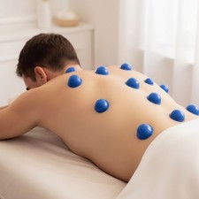 12 Stück Silikon Schröpfen