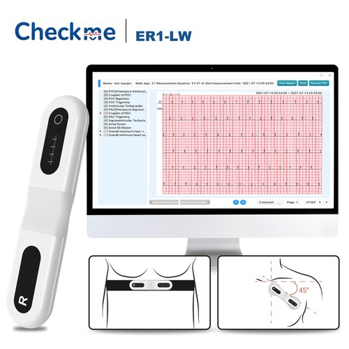 Checkme langzeit ekg - checkme, langzeit-ekg-gerät